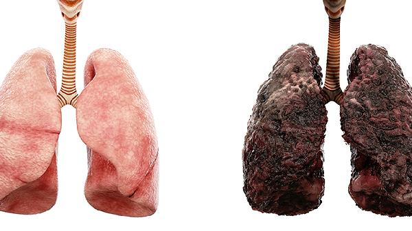 医生调查发现：癌症患者每天睡午觉，不出半年，或有这6大变化？
