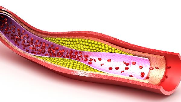 这些抗衰、养颜、防心脑血管病的食物,就藏在你家餐桌上-易网<a href=/ target=_blank class=infotextkey>健康养生</a>网 这些抗衰、养颜、防心脑血管病的食物,就藏在你家餐桌上