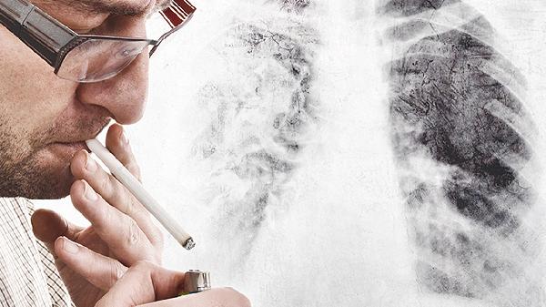 老年人要戒烟吗？医生：过了 65 岁以后，戒烟前要注意这 5 件事