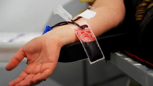 血脂异常别只怪肥肉！你常吃的烘焙/油炸食品，可能在悄悄“推高坏胆固醇”