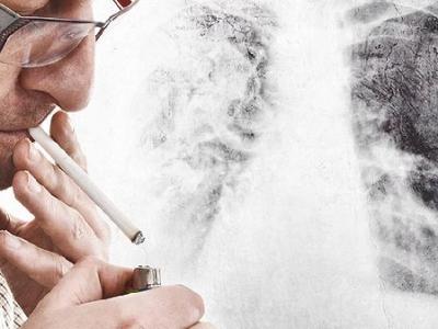 身体没有明显不适，却查出肺癌？医生多次提醒：若有4异常，或有癌变风险