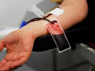 查出血脂异常的人注意：除了少吃肉，这几个生活习惯更容易影响指标