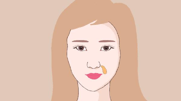 全脸脂肪填充包括填鼻基底吗
