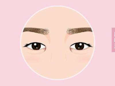 单眼皮肿眼泡怎么办