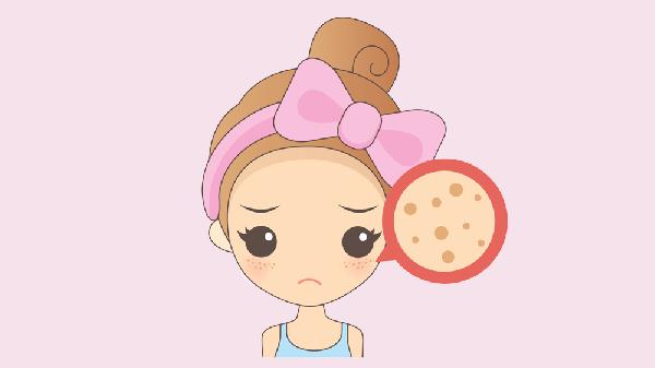 怎么用医美去除雀斑