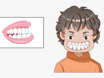 长期贴双眼皮贴会变双眼皮吗