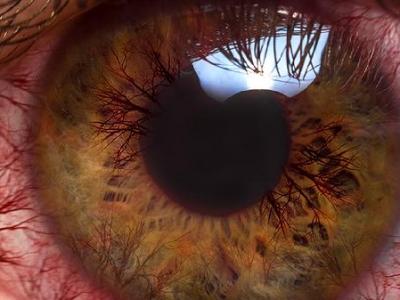 眼红别人结婚得红眼病会传染吗
