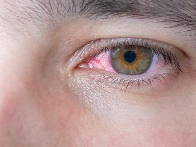 双眼复视不治疗的后果